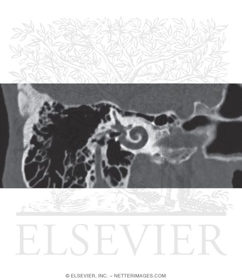 Inner Ear