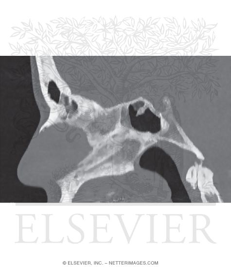 Nasal Septum, Components