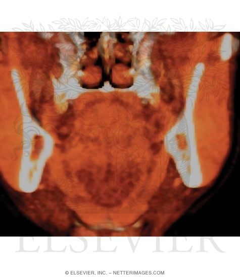Watermarked preview of unlabeled image: Tongue, Coronal Section