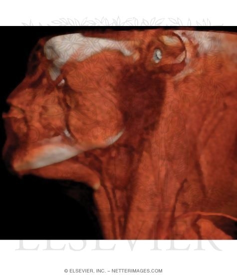 Watermarked preview of unlabeled image: Parotid and Submandibular Salivary Glands