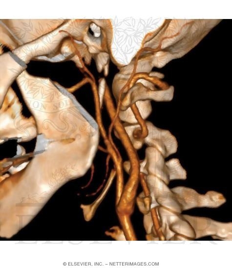 Carotid Arteries In the Neck