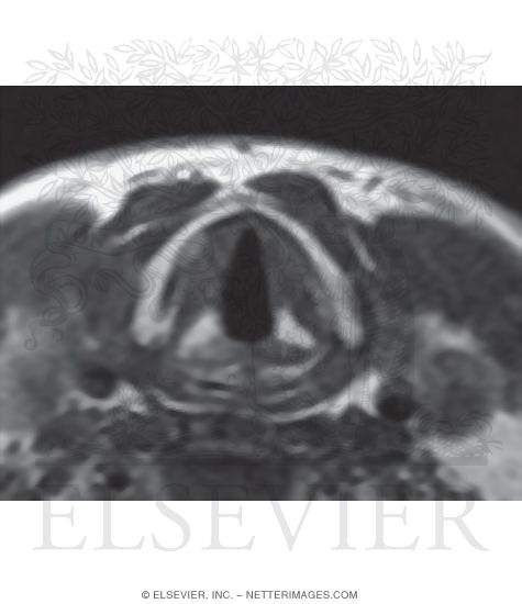Larynx
