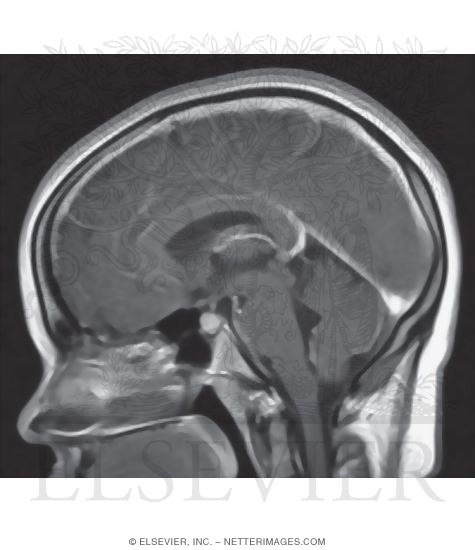 Cerebral Venous System