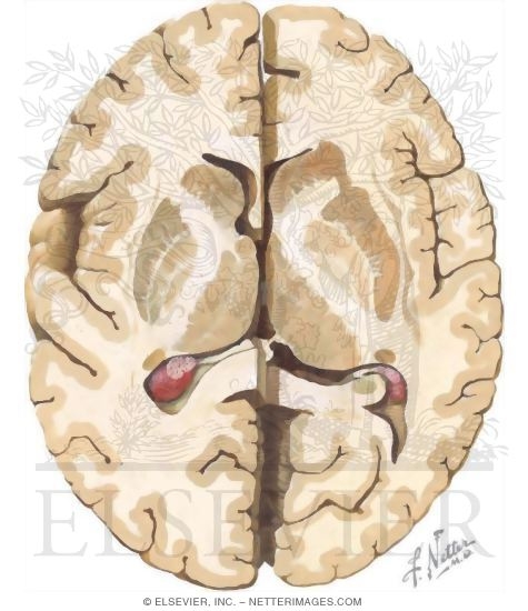 Cerebral Cortex and Basal Ganglia, Axial Section