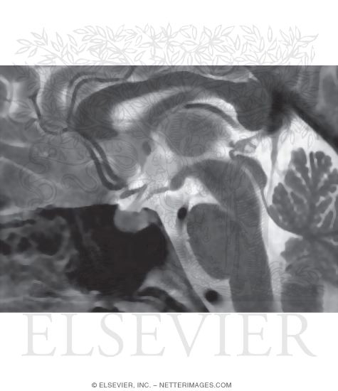 Brainstem, Midsagittal View