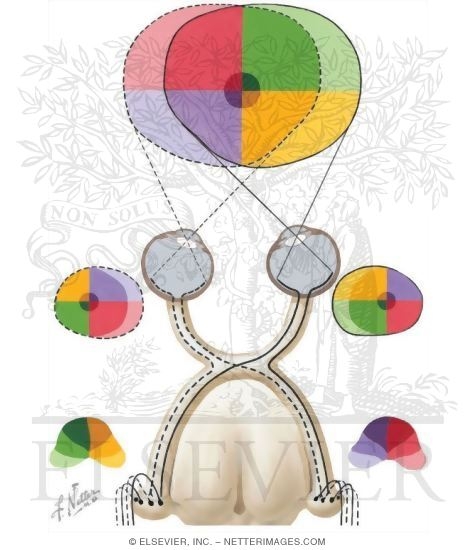 Watermarked preview of unlabeled image: Optic Pathway