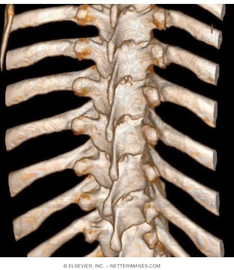 Thoracic Spine