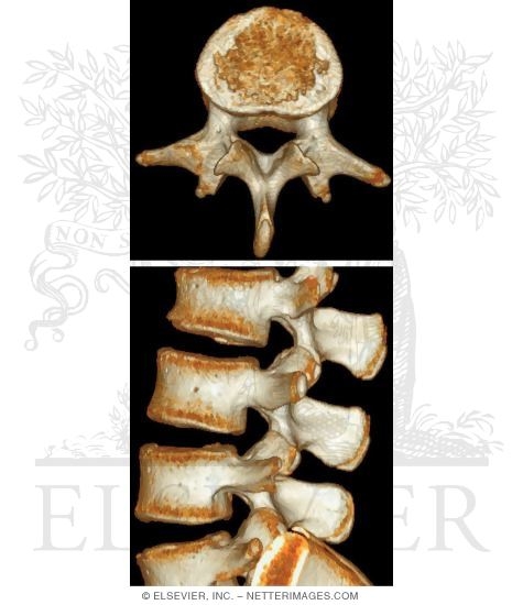 Lumbar Vertebrae