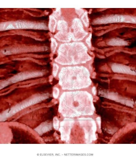 Intercostal Vessels and Nerves, Posterior