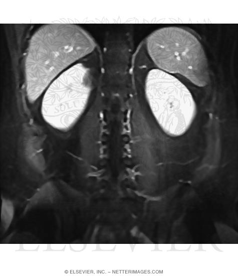 Watermarked preview of unlabeled image: Vertebral Venous Plexuses