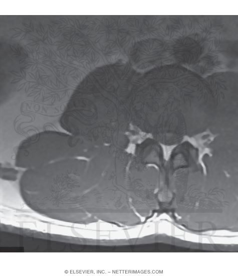 Watermarked preview of unlabeled image: Lumbar Region, Cross Section