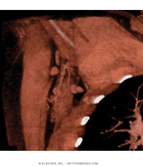 Lymph Nodes of the Axilla