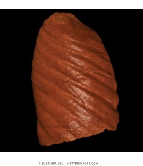 Right Lung, Lateral View