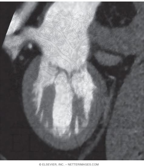 Left Side of the Heart