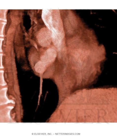Posterior Mediastinum