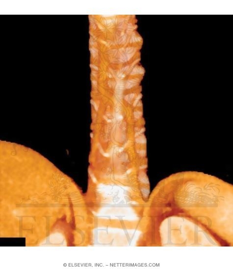 Azygos and Hemiazygos Veins