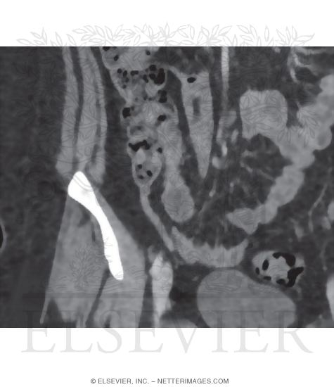 Appendix