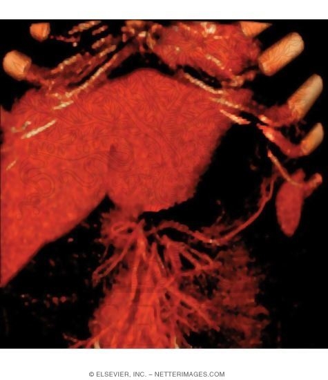 Watermarked preview of unlabeled image: Porta Hepatis and Greater Omentum