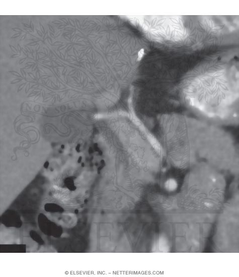 Porta Hepatis