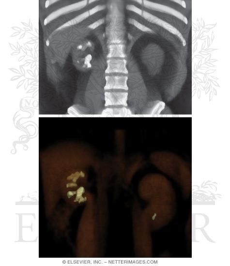 Watermarked preview of unlabeled image: Kidneys and Ureters