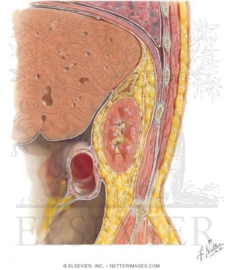 Kidney, Oblique Sagittal Section