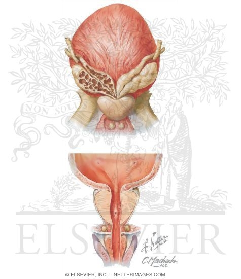 Bladder, Prostate, and Seminal Vesicles