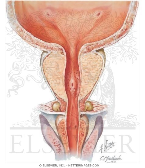 Prostate, Coronal View