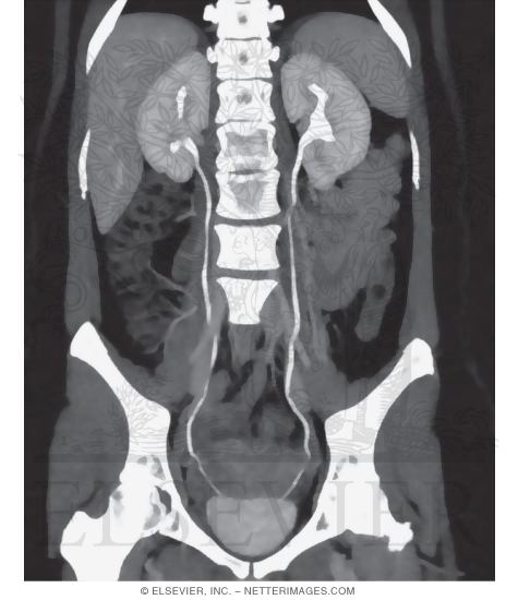 Ureters
