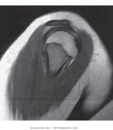 Watermarked preview of unlabeled image: Shoulder Joint, Anterior and Sagittal Views