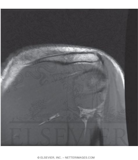 Watermarked preview of unlabeled image: Quadrangular and Triangular Spaces