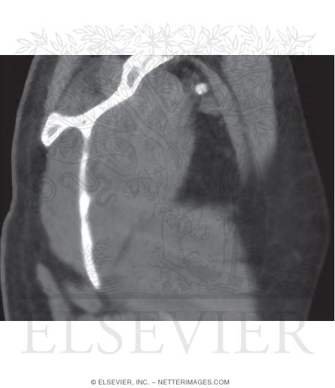 Axillary Region