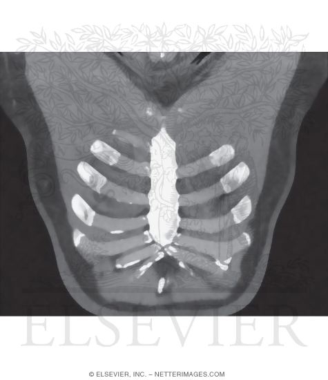 Watermarked preview of unlabeled image: Pectoralis Major