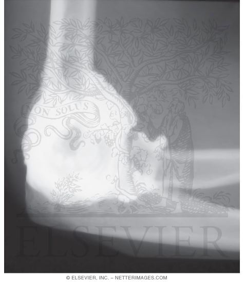 Elbow, Lateral View