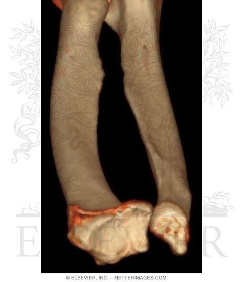 Watermarked preview of unlabeled image: Radius and Ulna