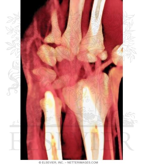 Extensor Muscles of the Wrist