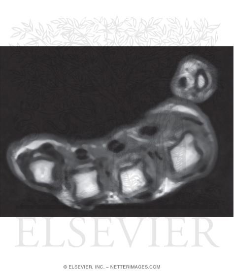 Watermarked preview of unlabeled image: Hand, Axial Section