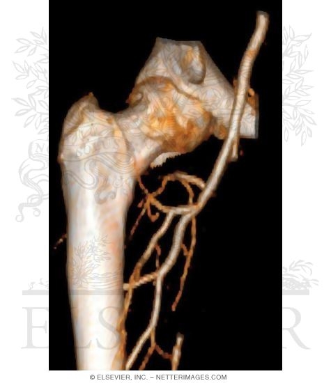 Watermarked preview of unlabeled image: Vasculature of the Femoral Head