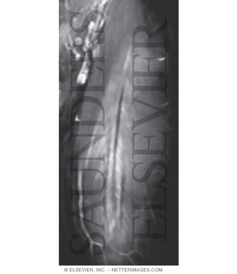 Watermarked preview of unlabeled image: Quadriceps Femoris Muscle Group