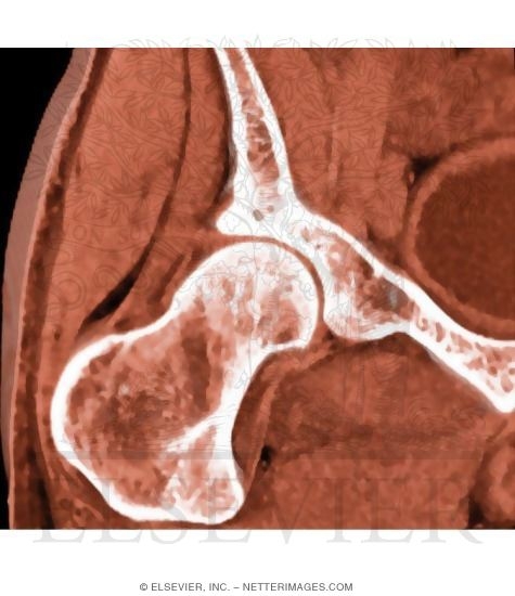 Deep Hip Muscles
