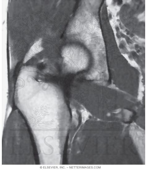 Watermarked preview of unlabeled image: Gluteal Region