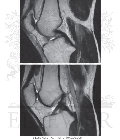 Watermarked preview of unlabeled image: Cruciate Ligaments