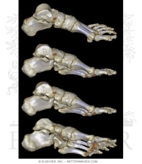Watermarked preview of unlabeled image: Foot Osteology, Medial View