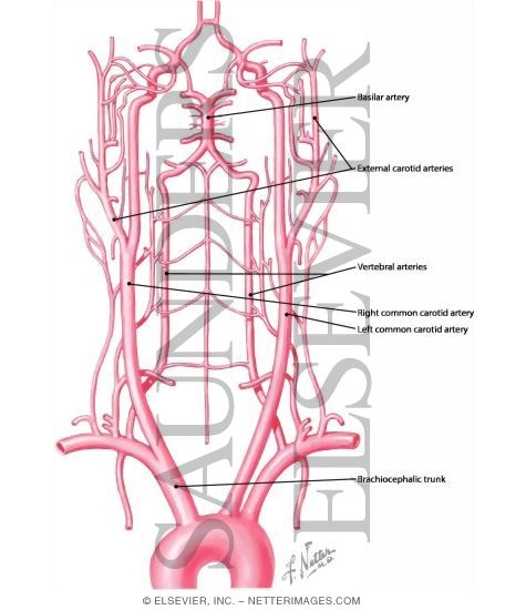 Schema of Blood Supply to Brain
Arteries to Brain: Schema