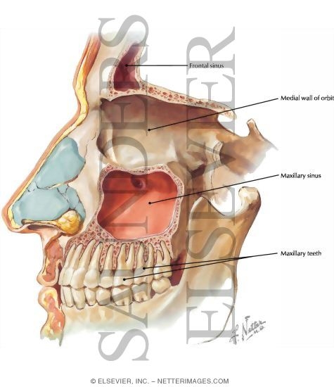 Paranasal Sinuses: Lateral Dissection