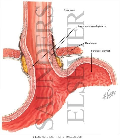 Watermarked preview of labeled image: Light Micrograph of the Esophagogastric Junction