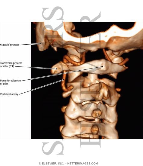 Watermarked preview of labeled image: Vertebral Artery, Atlas