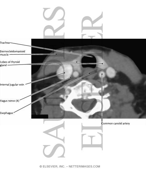 Neck, Axial Section at Thyroid Gland