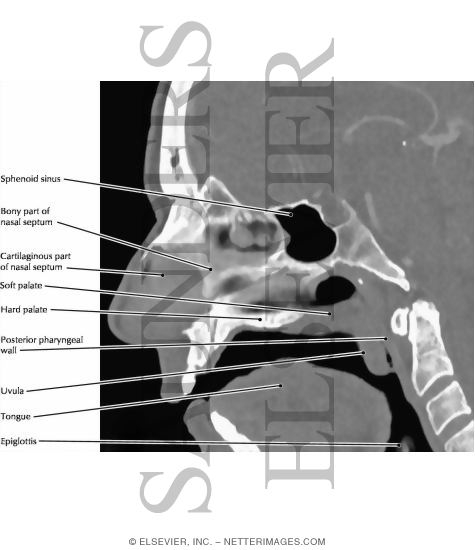 Watermarked preview of labeled image: Nasal Septum, Hard and Soft Palate