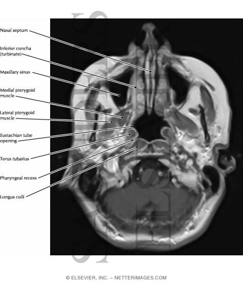 Nose and Paranasal Sinuses
