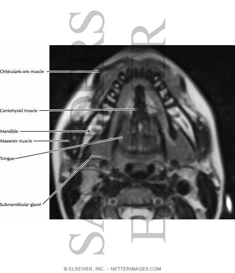 Floor Of Mouth